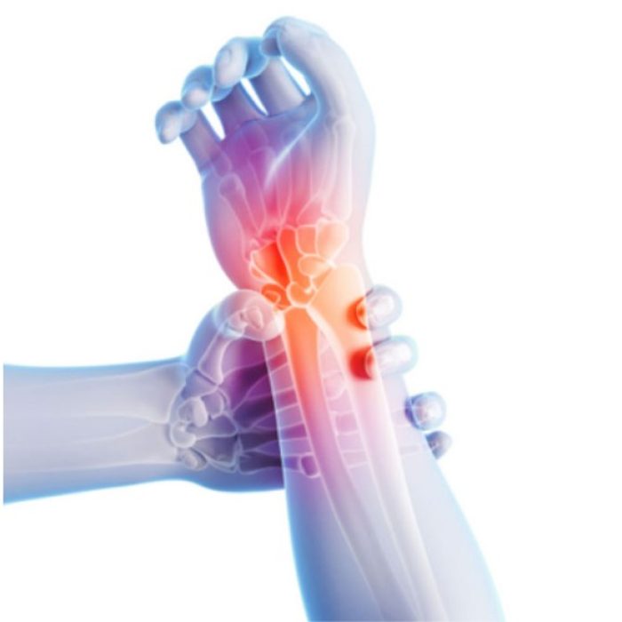 Neuropathic-Pain-1024x576