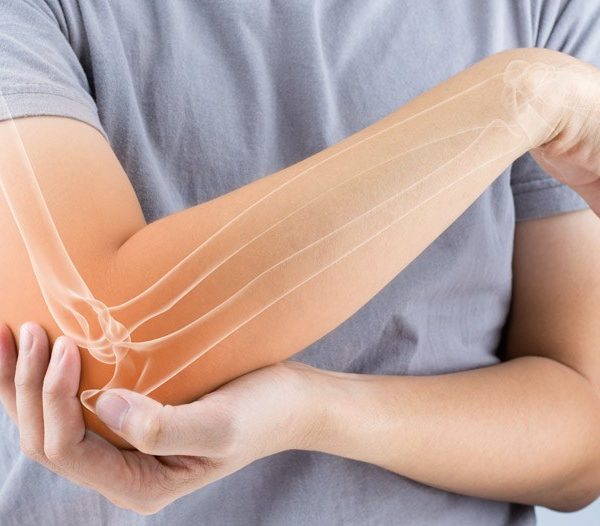 tennis-elbow tennis-elbow